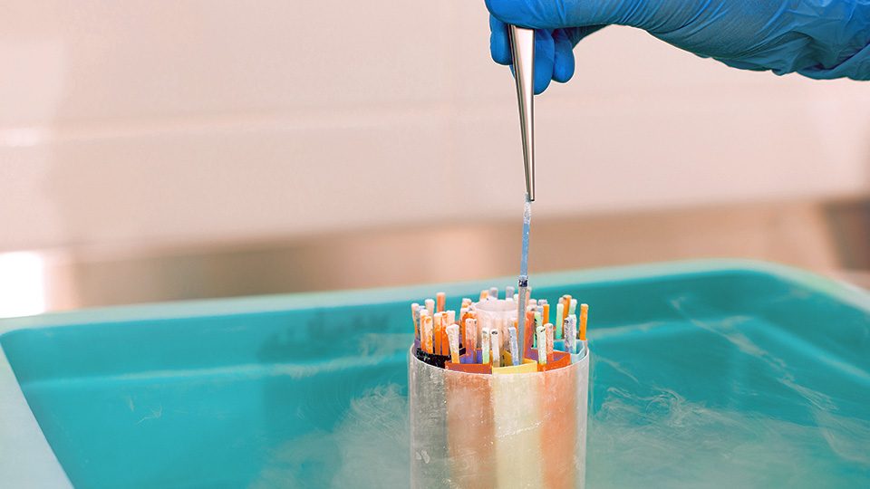 Kryokonservierung – Kinderwunsch Kö