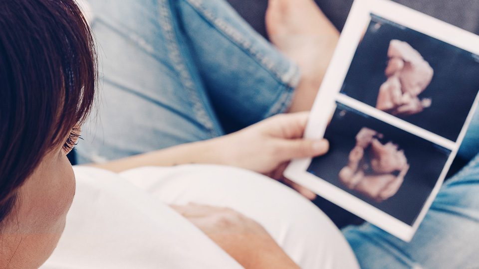 Schwangere Frau bertrachtet Ultraschall-Foto – Kinderwunsch Kö